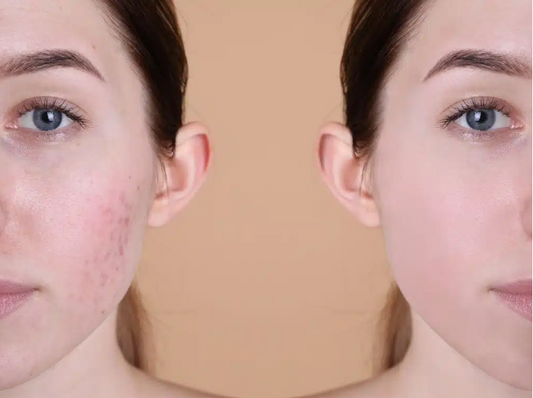 Masque Purifiant à l’Argile – Peau Nette & Éclat Naturel